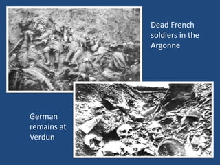 German 
remains at 
Verdun 
Dead French 
soldiers in the 
Argonne 
 