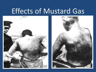 Effects of Mustard Gas 
 