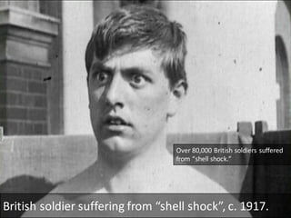 World War I trauma | PDF