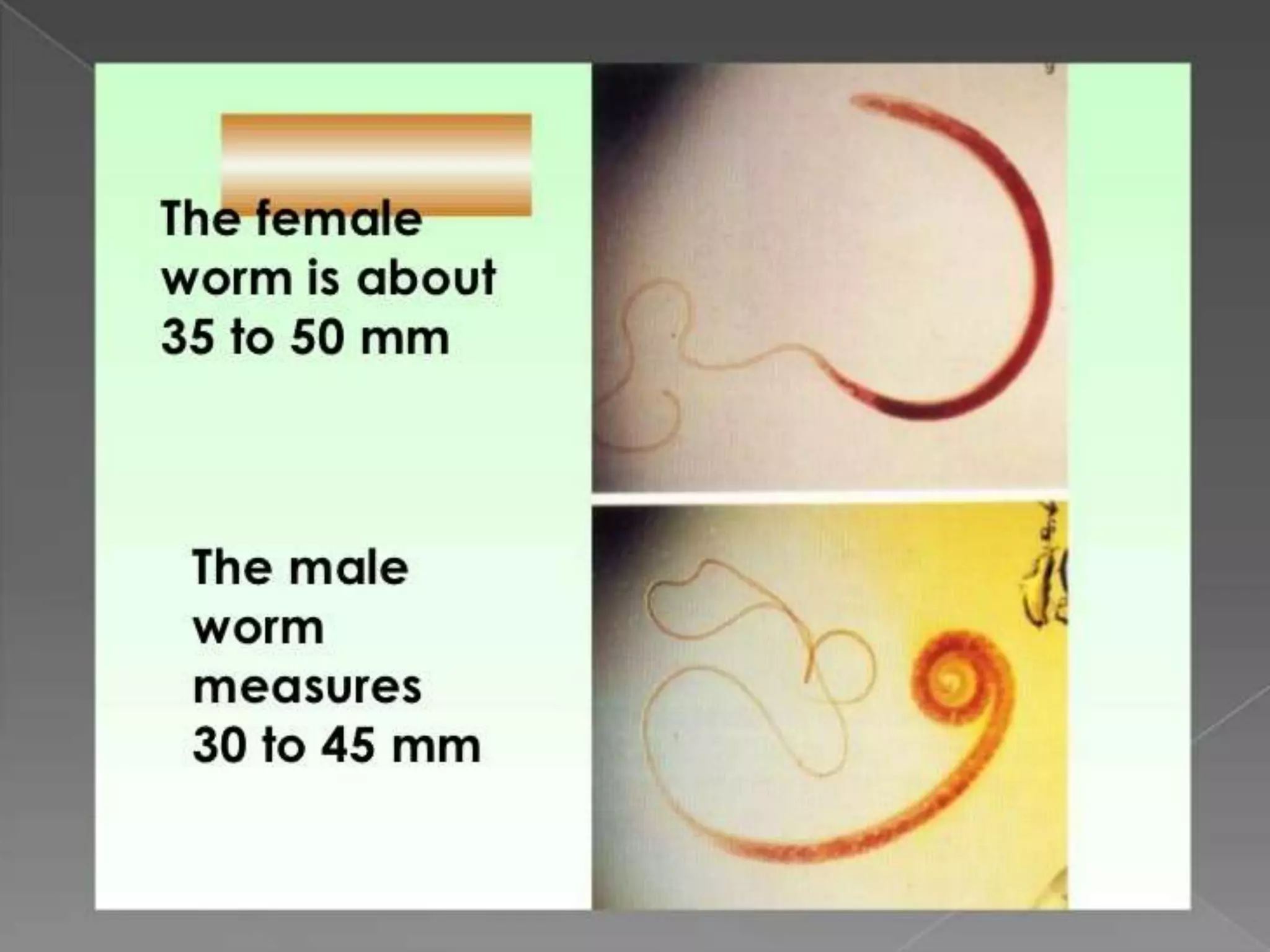 Worm infestation:tape worm and hook worm