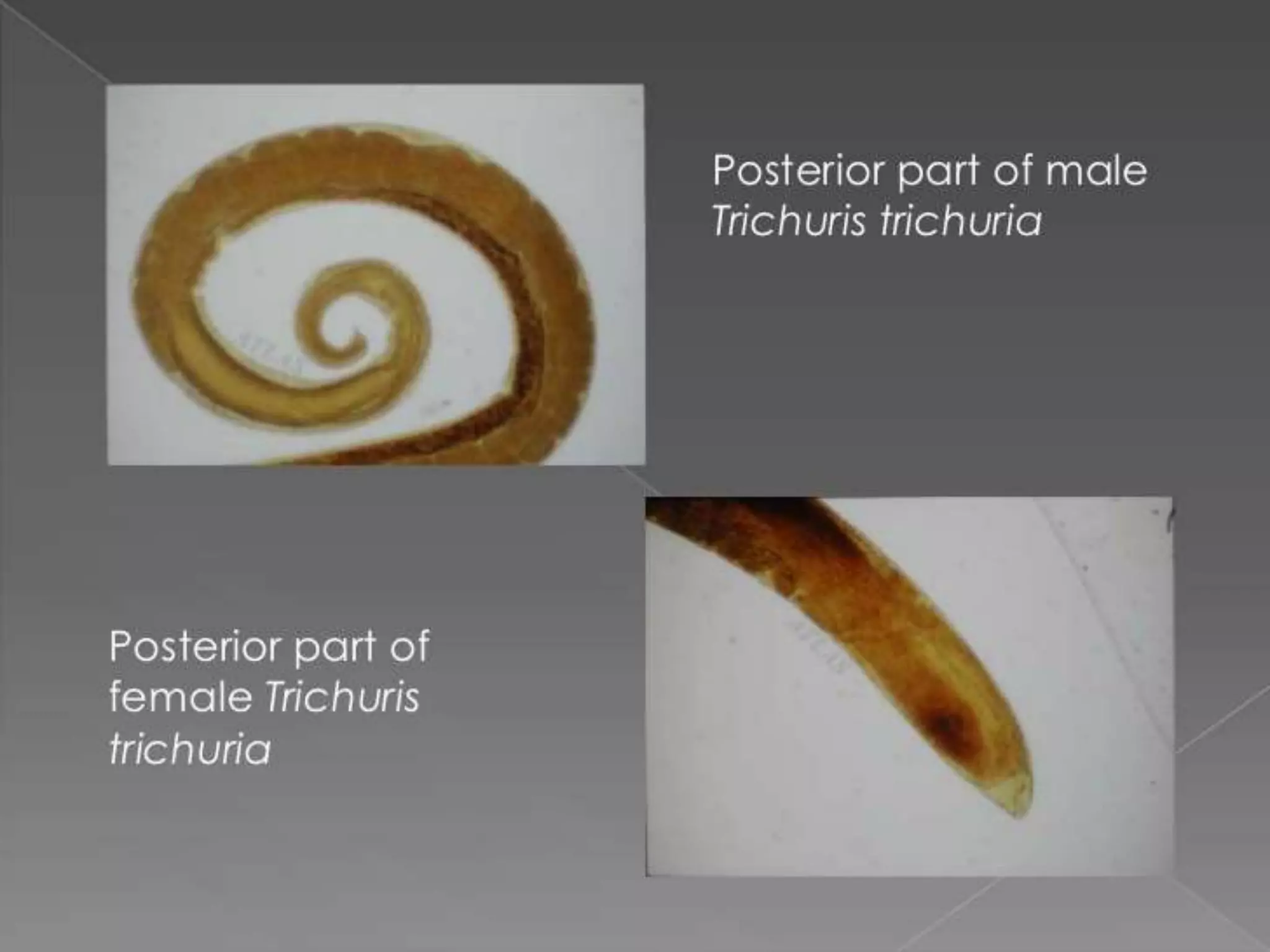 Worm infestation:tape worm and hook worm