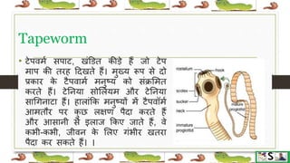 Worm infestation in children hindi | PPTX