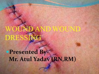 WOUND AND WOUND
DRESSING
Presented By-
Mr. Atul Yadav (RN,RM)
 