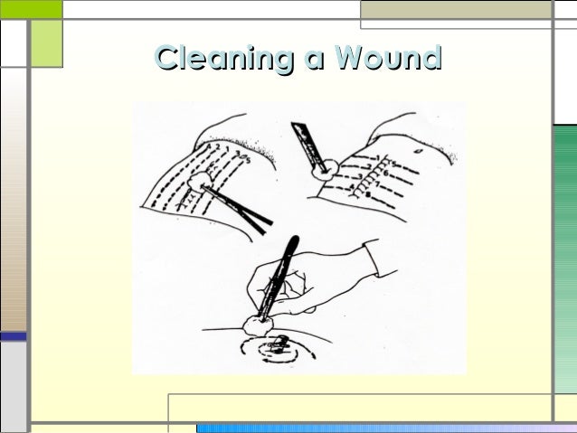 cleaning wounds wound healing and care presentation cleaning wounds wound healing and care presentation
