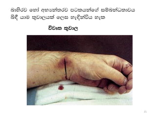 Types of Wounds and First Aid. find you | PDF