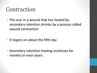 wound-care.ppt