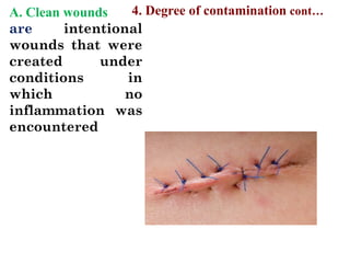 A. Clean wounds
are intentional
wounds that were
created under
conditions in
which no
inflammation was
encountered
4. Degree of contamination cont…
 