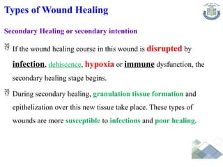 Types of Wound Healing
Secondary Healing or secondary intention
 If the wound healing course in this wound is disrupted by
infection, dehiscence, hypoxia or immune dysfunction, the
secondary healing stage begins.
 During secondary healing, granulation tissue formation and
epithelization over this new tissue take place. These types of
wounds are more susceptible to infections and poor healing.
 