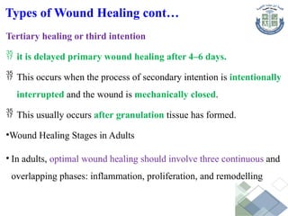 Tertiary healing or third intention
 it is delayed primary wound healing after 4–6 days.
 This occurs when the process of secondary intention is intentionally
interrupted and the wound is mechanically closed.
 This usually occurs after granulation tissue has formed.
•Wound Healing Stages in Adults
• In adults, optimal wound healing should involve three continuous and
overlapping phases: inflammation, proliferation, and remodelling
Types of Wound Healing cont…
 