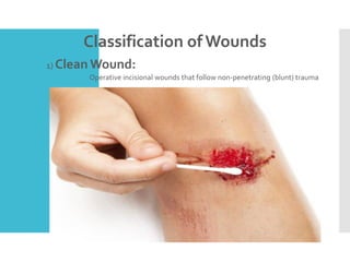 Classification of Wounds
 1) Clean Wound:
 Operative incisional wounds that follow non-penetrating (blunt) trauma
 .
 