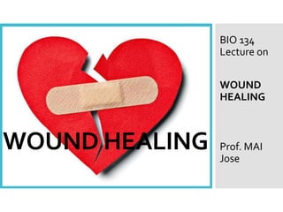 WOUND HEALING
BIO 134
Lecture on
WOUND
HEALING
Prof. MAI
Jose
 