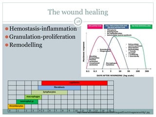 The wound healing
⚫Hemostasis-inflammation
⚫Granulation-proliferation
⚫Remodelling
capillaries
fibroblasts
lymphocytes
mac...
