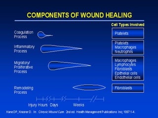 Comprehensive Overview of Wound Healing Phases and Mechanisms | PPT