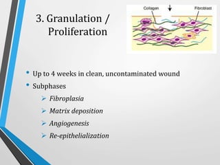 3. Granulation /
Proliferation
• Up to 4 weeks in clean, uncontaminated wound
• Subphases
 Fibroplasia
 Matrix deposition
 Angiogenesis
 Re-epithelialization
 