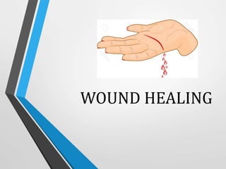 WOUND HEALING
 