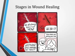 Stages in Wound Healing
 