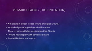 PRIMARY HEALING (FIRST INTENTION)
• ♦ It occurs in a clean incised wound or surgical wound.
• Wound edges are approximated with sutures.
• There is more epithelial regeneration than fibrosis.
• Wound heals rapidly with complete closure.
• Scar will be linear and smooth.
 