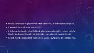 • Keloid continues to grow even after 6 months, may be for many years.
• It extends into adjacent normal skin.
• It is brownish black/ pinkish black (due to vascularity) in colour, painful,
tender and sometimes hyperaesthetic; spreads and causes itching.
• Keloid may be associated with Ehlers-Danlos syndrome or scleroderma.
 