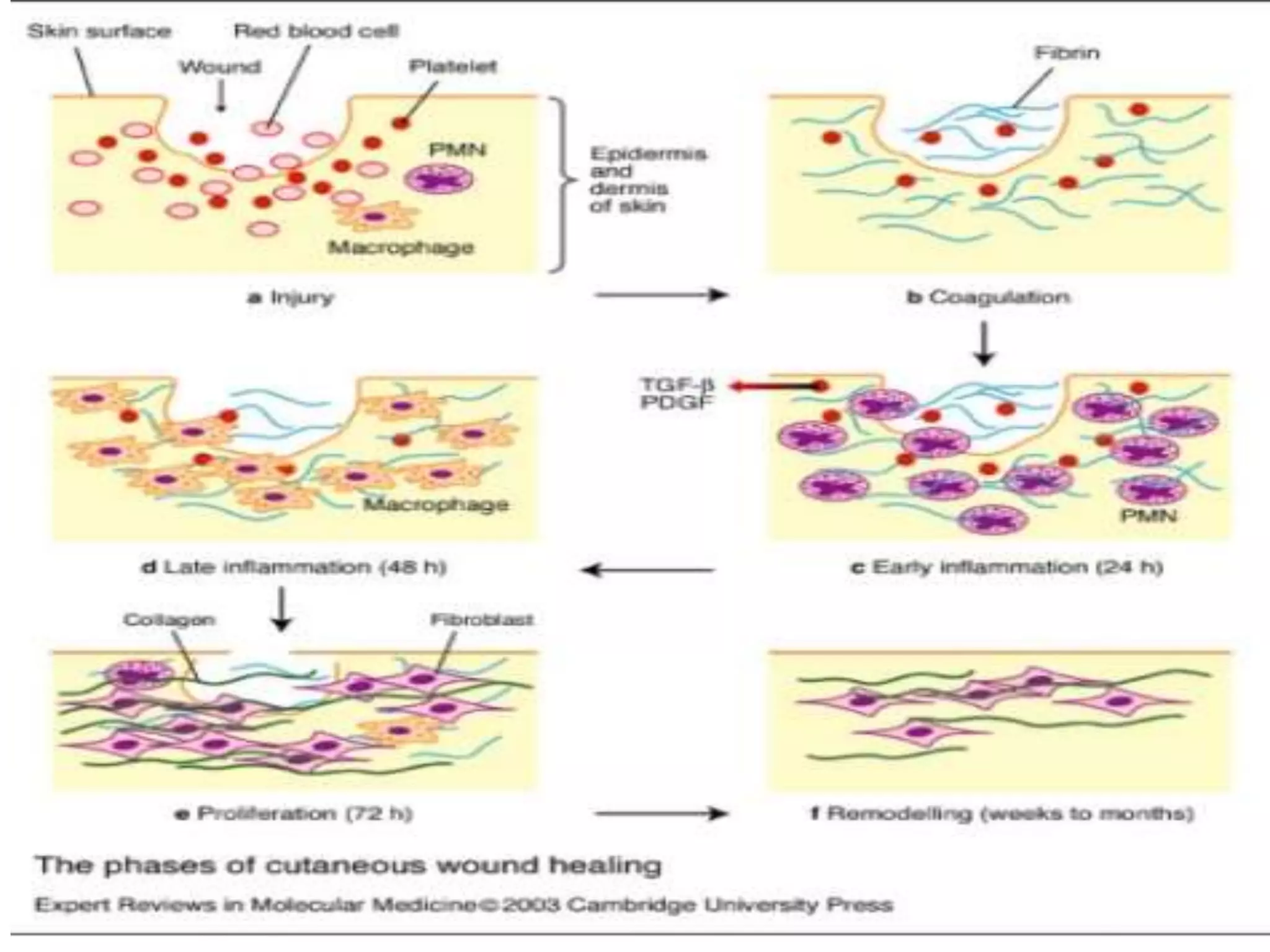 Wound and Wound healing | PPTX