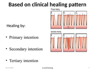 wound wound healing and infection for clinicac1-1.pptx