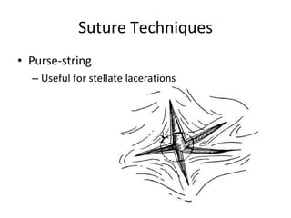 Suture Techniques <ul><li>Purse-string </li></ul><ul><ul><li>Useful for stellate lacerations </li></ul></ul>