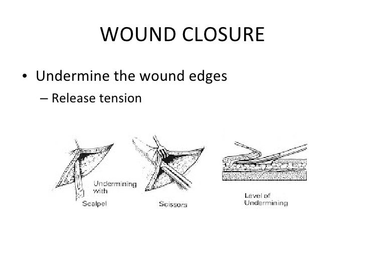 Woundcare