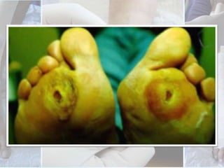 Wound infection 	Wounds are considered infected if they have perulence and/or at least 2 of the following signs and symptoms: pain, warmth, erythema, oedema, lymphangitis or loss of function. 