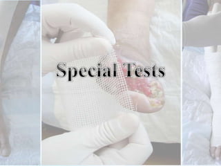 Buergers Elevation Test• Elevate limb until dorsal veins emptied• Plantar surface of foot turns pale (1 min.)• (If severe - ? Widespread Insufficiency)