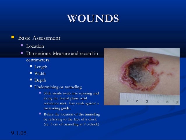 Denuded wound Nude Photos 43 Denuded wound Nude Photos 58