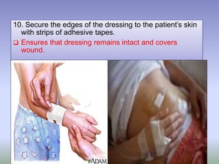 10. Secure the edges of the dressing to the patient’s skin
with strips of adhesive tapes.
 Ensures that dressing remains intact and covers
wound.
 