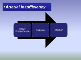 Tissue
Hypoperfusion
Hypoxia Infection
Arterial Insufficiency
 