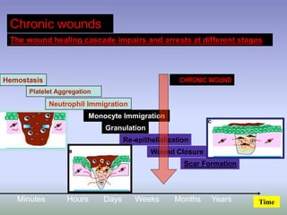 Chronic wounds
The wound healing cascade impairs and arrests at different stages
Hemostasis
Platelet Aggregation
Neutrophil Immigration
Monocyte Immigration
Granulation
Re-epithelialization
Wound Closure
Scar Formation
Minutes Hours Days Weeks Months Years Time
CHRONIC WOUND
 