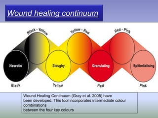 Wound healing continuum
Wound Healing Continuum (Gray et al. 2005) have
been developed. This tool incorporates intermediate colour
combinations
between the four key colours
 