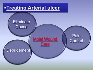 Etiology:Treating Arterial ulcer
Eliminate
Cause
Pain
ControlMoist Wound
Care
Debridement
 