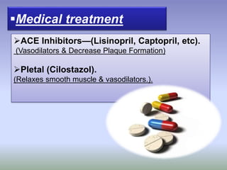 Medical treatment
ACE Inhibitors—(Lisinopril, Captopril, etc).
(Vasodilators & Decrease Plaque Formation)
Pletal (Cilostazol).
(Relaxes smooth muscle & vasodilators.).
 