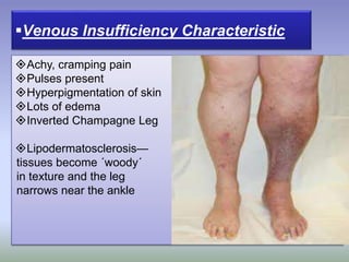 Achy, cramping pain
Pulses present
Hyperpigmentation of skin
Lots of edema
Inverted Champagne Leg
Lipodermatosclerosis—
tissues become ´woody´
in texture and the leg
narrows near the ankle
Venous Insufficiency Characteristic
 