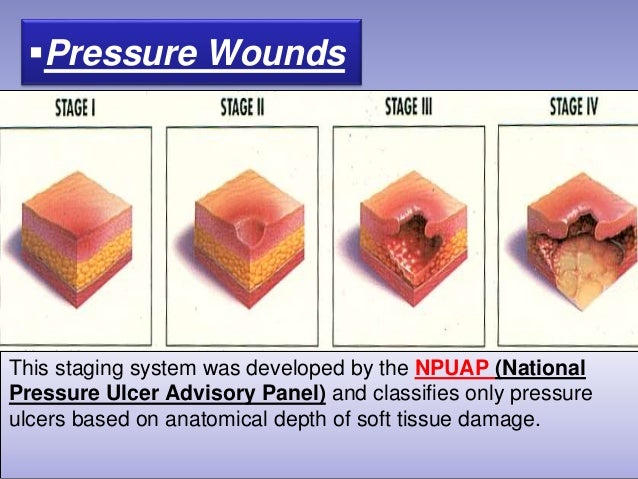 Wound Staging Chart