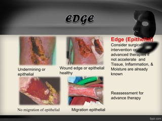 Perawatan luka modern, wound care, wound management | PPT