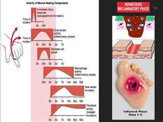 HEMOSTASIS
INFLAMMATORY PHASE 11
 
