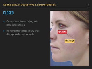 WOUND CARE: 3. WOUND TYPE & CHARACTERISTICS
CLOSED
▸ Contusion: tissue injury w/o
breaking of skin
▸ Hematoma: tissue injury that
disrupts a blood vessels
CONTUSION
HEMATOMA
16
 