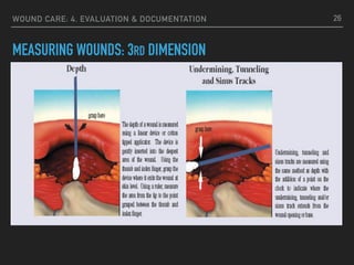 WOUND CARE: 4. EVALUATION & DOCUMENTATION
MEASURING WOUNDS: 3RD DIMENSION
26
 