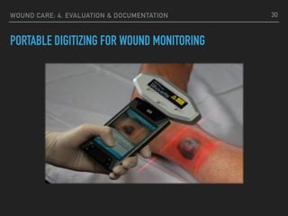 WOUND CARE: 4. EVALUATION & DOCUMENTATION
PORTABLE DIGITIZING FOR WOUND MONITORING
30
 
