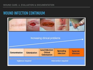 WOUND CARE: 4. EVALUATION & DOCUMENTATION
WOUND INFECTION CONTINUUM
 