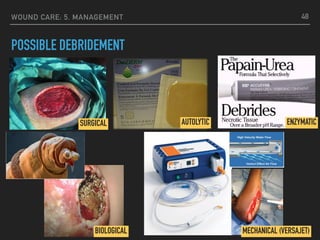 WOUND CARE: 5. MANAGEMENT
POSSIBLE DEBRIDEMENT
48
SURGICAL AUTOLYTIC ENZYMATIC
BIOLOGICAL MECHANICAL (VERSAJET)
 