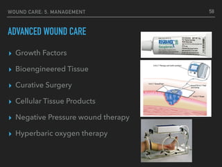 WOUND CARE: 5. MANAGEMENT
ADVANCED WOUND CARE
▸ Growth Factors
▸ Bioengineered Tissue
▸ Curative Surgery
▸ Cellular Tissue Products
▸ Negative Pressure wound therapy
▸ Hyperbaric oxygen therapy
58
 
