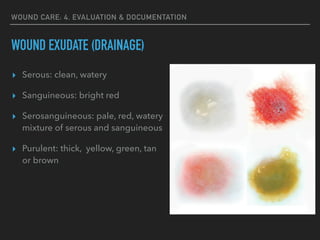 Wound care