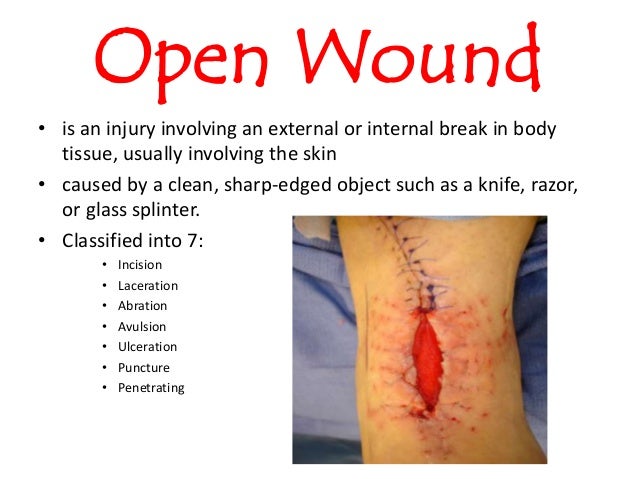 wound care and treatment for nursing wound care nursing