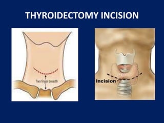 Lahey Incision Wound care essentials | PPTX