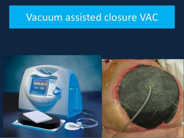 Wound Care For Nurses wound-care-for-nurses