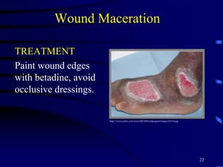 Wound Maceration
TREATMENT
Paint wound edges
with betadine, avoid
occlusive dressings.
22
https://wocn.confex.com/wocn/2007AM/techprogram/images/2414-0.jpg
 